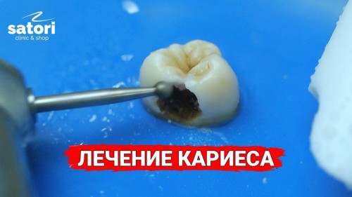 Відеотека